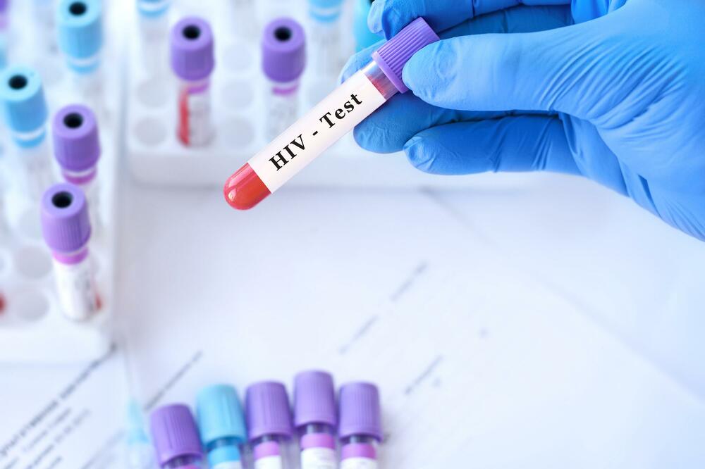 Čovječanstvo je korak bliže lijeku za HIV: Pronađen novi način da se virus učini vidljivim unutar bijelih krvnih zrnaca
