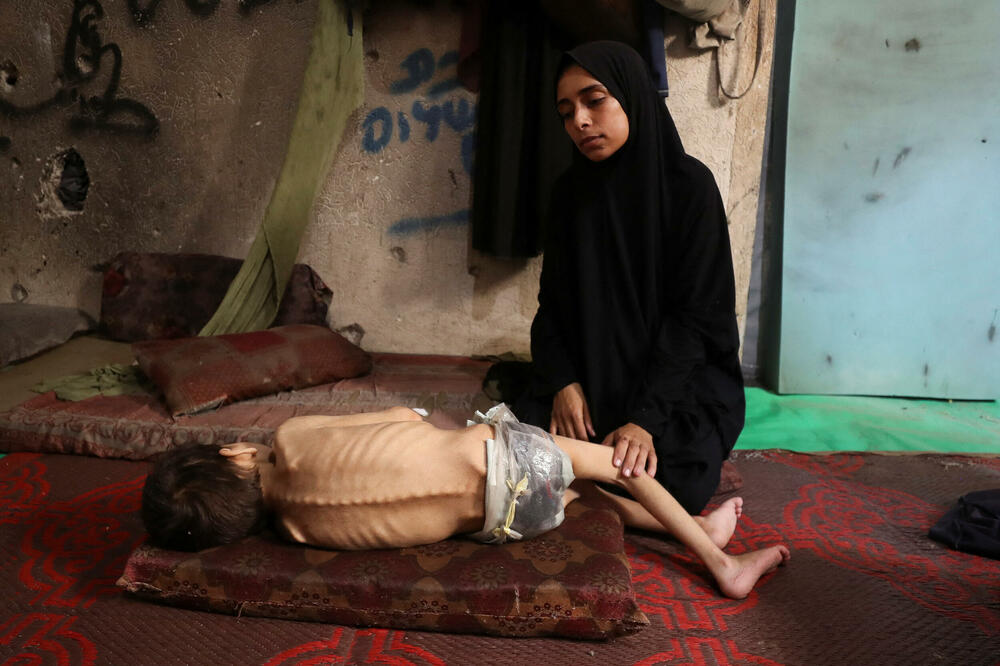 Gaza: 81 dijete umrlo od neuhranjenosti