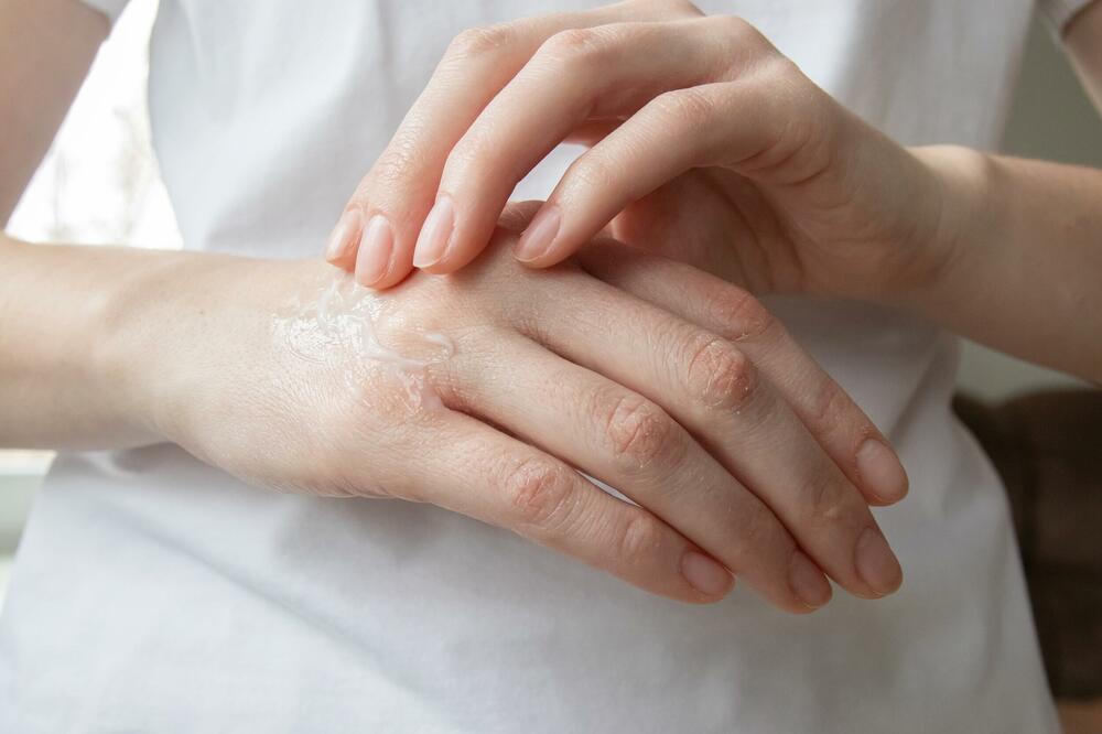 Kako da vam po hladnom vremenu ruke ne ispucaju i da uvijek izgledaju uredno