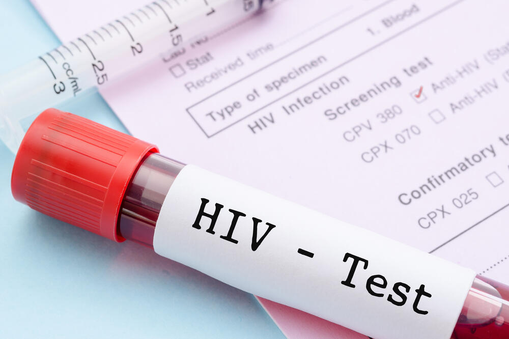 Njemački naučnici pronašli antitijelo protiv HIV-a