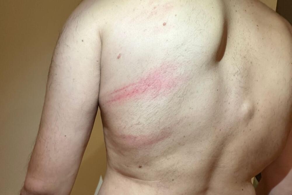 Podgoričanin: Policajci me pretukli, vrijeđali me i ponižavali, primio sam pet injekcija