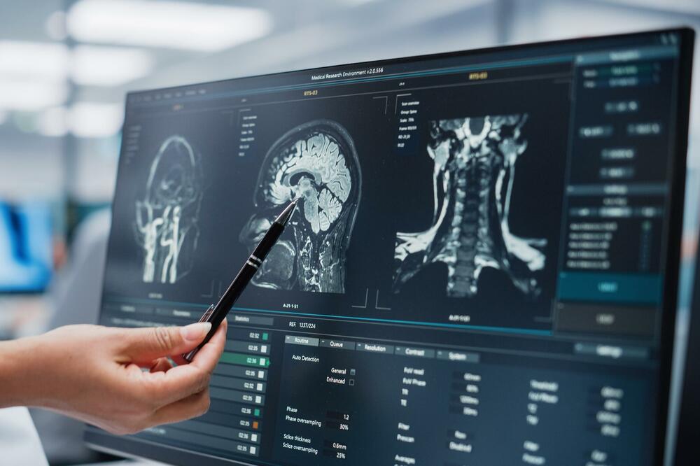 S. Makedonija slala u SAD mozgove ljudi radi istraživanja